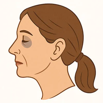 DARK CIRCLES